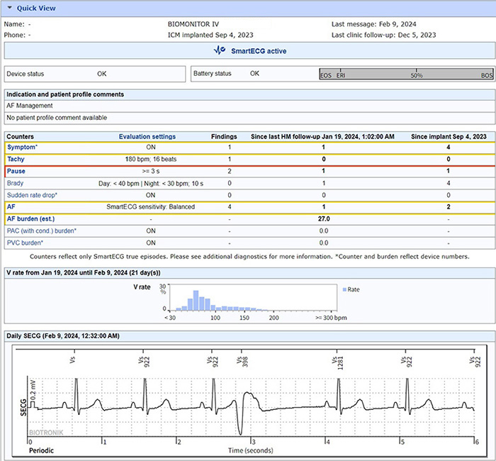 Confidence from BIOTRONIK Home Monitoring